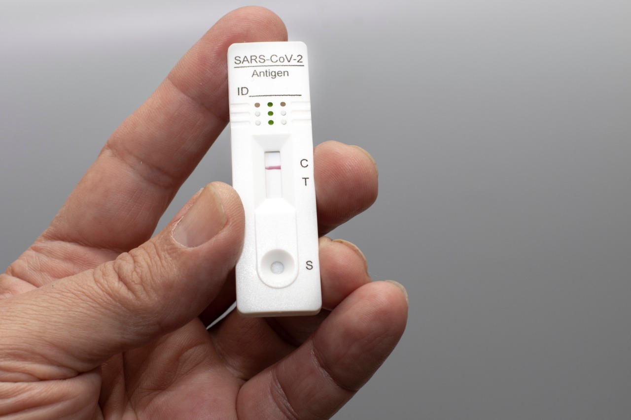 Cuatro empresas autorizadas para importar autopruebas de COVID-19 Cuatro empresas autorizadas para importar autopruebas de COVID-19